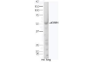 Mouse lung lysates probed with Rabbit Anti-ADRB1 Polyclonal Antibody, Unconjugated  at 1:5000 for 90 min at 37˚C. (ADRB1 Antikörper  (AA 181-250))