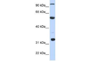 ApoBEC1 antibody used at 1 ug/ml to detect target protein. (APOBEC1 Antikörper  (N-Term))