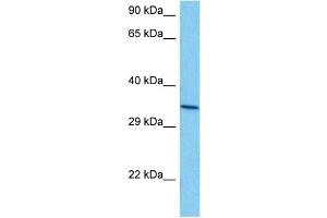 Western Blotting (WB) image for anti-Annexin A5 (ANXA5) (N-Term) antibody (ABIN2774910)