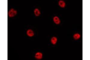 ABIN6275725 staining HepG2 by IF/ICC. (Tbpl2 Antikörper  (Internal Region))
