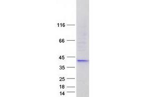 Validation with Western Blot