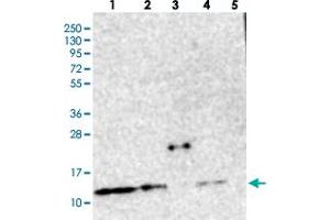 Western blot analysis of Lane 1: RT-4, Lane 2: U-251 MG, Lane 3: Human Plasma, Lane 4: Liver, Lane 5: Tonsil with CHCHD5 polyclonal antibody  at 1:250-1:500 dilution.