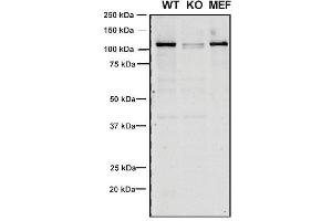 Western Blot analysis of Human, Mouse A549, MEF showing detection of VPS35 protein using Mouse Anti-VPS35 Monoclonal Antibody, Clone 8A3 (ABIN6932957). (VPS35 Antikörper  (Atto 390))