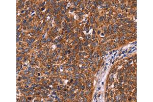 Immunohistochemistry (IHC) image for anti-Coiled-Coil Domain Containing 106 (CCDC106) antibody (ABIN2423069)