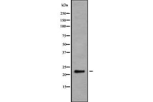 Western blot analysis NRSN2 using K562 whole cell lysates (NRSN2 Antikörper  (C-Term))
