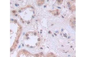 IHC-P analysis of Kidney tissue, with DAB staining. (KPNB1 Antikörper  (AA 21-441))
