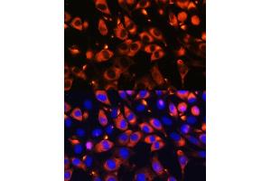 Immunofluorescence analysis of L929 cells using B9D1 Rabbit pAb (ABIN6133363, ABIN6137409, ABIN6137410 and ABIN6223982) at dilution of 1:100. (B9D1 Antikörper  (AA 1-130))