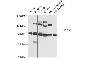 Western blot analysis of extracts of various cell lines, using RBM15B Antibody (ABIN6133322, ABIN6146763, ABIN6146764 and ABIN6225211) at 1:1000 dilution. (RBM15B Antikörper  (AA 540-720))