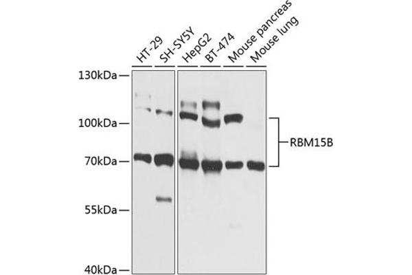 RBM15B 抗体  (AA 540-720)