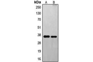 Western blot analysis of FAIM2 expression in U251 (A), EL4 (B) whole cell lysates. (FAIM2 Antikörper  (N-Term))