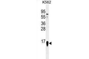 Western Blotting (WB) image for anti-Ribosomal Protein S19 (RPS19) antibody (ABIN2996506) (RPS19 Antikörper)