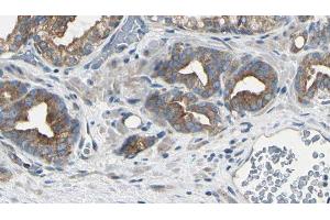ABIN6279781 at 1/100 staining Human prostate tissue by IHC-P. (RPL22/L1 Antikörper)