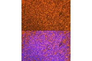 Immunofluorescence analysis of mouse spleen cells using EBI3 Rabbit mAb (ABIN7268011) at dilution of 1:100 (40x lens). (EBI3 Antikörper)