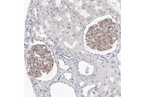 Immunohistochemical staining (Formalin-fixed paraffin-embedded sections) of human kidney with DLGAP3 polyclonal antibody  shows moderate positivity in cells in glomeruli. (DLGAP3 Antikörper)