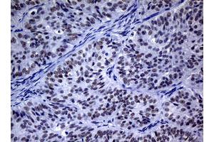 Image no. 3 for anti-Nibrin (NBN) (AA 183-460) antibody (ABIN1491067) (Nibrin Antikörper  (AA 183-460))