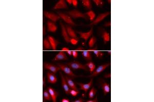 Immunofluorescence analysis of U2OS cells using SMAD4 antibody. (SMAD4 Antikörper  (AA 160-450))