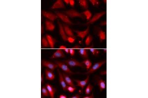 Immunofluorescence analysis of U2OS cells using SMAD4 antibody.