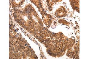 Immunohistochemistry (IHC) image for anti-Chemokine (C-C Motif) Ligand 17 (CCL17) antibody (ABIN1679017) (CCL17 Antikörper)