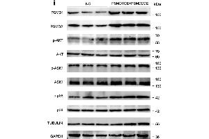 PSMD1 and PSMD2 regulate the expression level of fatty acids (FAs) and lipid synthesis-related genes. (AKT1 Antikörper  (pSer473))