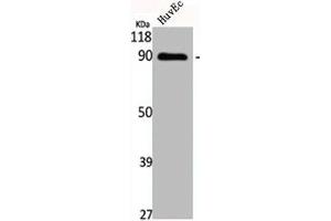 Western Blot analysis of HuvEc cells using Cadherin-16 Polyclonal Antibody (Cadherin-16 Antikörper  (C-Term))