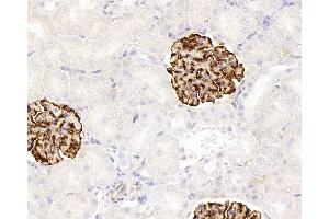 Immunohistochemistry (Paraffin-embedded Sections) (IHC (p)) image for anti-Nestin (NES) antibody (ABIN7249948)