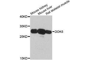 Western blot analysis of extracts of various cell lines, using DOK5 antibody. (DOK5 Antikörper)