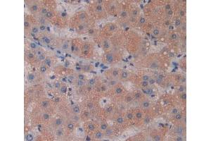 IHC-P analysis of liver tissue, with DAB staining. (Phospholipase C delta 3 Antikörper  (AA 528-789))