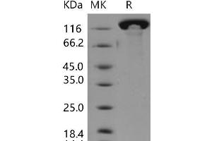 Contactin 3 (Plasmacytoma Associated) (CNTN3) protein (His tag)