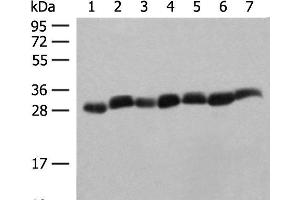 Western blot analysis of Hela cell Mouse spleen tissue Mouse liver tissue PC3 cell HL60 cell A549 cell NIH/3T3 cell lysates using PSMA3 Polyclonal Antibody at dilution of 1:350 (PSMA3 Antikörper)