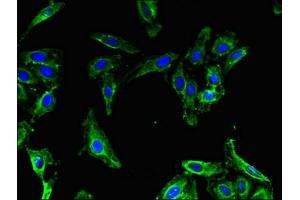 Immunofluorescent analysis of Hela cells using ABIN7159774 at dilution of 1:100 and Alexa Fluor 488-congugated AffiniPure Goat Anti-Rabbit IgG(H+L) (MAP1LC3B2 Antikörper  (AA 1-47))