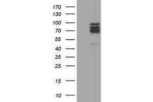 Western Blotting (WB) image for anti-CCR4-NOT Transcription Complex Subunit 4 (CNOT4) (AA 190-455) antibody (ABIN1491099) (CNOT4 Antikörper  (AA 190-455))