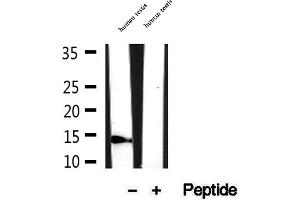 Western blot analysis of extracts of human testis tissue, using NA14 antibody. (SSNA1 Antikörper  (N-Term))