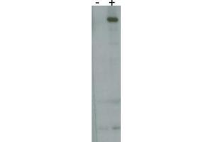 RK8 (LRRK2) Antibody  h detect over-expressed human LRRK2 protein. (LRRK2 Antikörper  (AA 930-961))