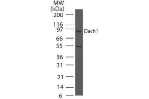 Image no. 2 for anti-Dachshund 1 (DACH1) (AA 474-491) antibody (ABIN960126) (DACH1 Antikörper  (AA 474-491))