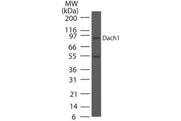 DACH1 Antikörper  (AA 474-491)