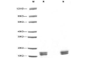 5μg of IL-2,Human was resolved with SDS-PAGE under reducing (R) and non-reducing (N) conditions and visualized by Coomassie Blue staining. (IL-2 Protein (AA 21-153))
