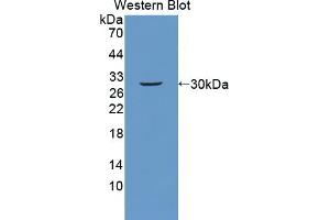 Detection of Recombinant PLXNB1, Mouse using Polyclonal Antibody to Plexin B1 (PLXNB1) (PLXNB1 Antikörper  (AA 1598-1849))