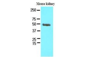 Western Blotting (WB) image for anti-Proteasome (Prosome, Macropain) 26S Subunit, Non-ATPase, 11 (PSMD11) (AA 1-422), (N-Term) antibody (ABIN371887) (PSMD11 Antikörper  (N-Term))