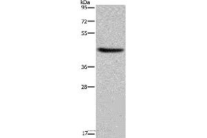 Western blot analysis of Human adrenal gland tissue, using HSD3B1 Polyclonal Antibody at dilution of 1:250