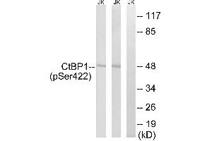 Immunohistochemistry analysis of paraffin-embedded human brain tissue, using CtBP1 (Phospho-Ser422) antibody. (CTBP1 Antikörper  (pSer422))