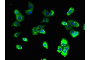 Immunofluorescent analysis of A431 cells using ABIN7175216 at dilution of 1:100 and Alexa Fluor 488-congugated AffiniPure Goat Anti-Rabbit IgG(H+L) (ATP6VA2 (AA 476-549), (Isoform 2) Antikörper)
