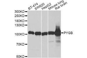 Western blot analysis of extracts of various cell lines, using PYGB antibody (ABIN6293330) at 1:1000 dilution. (PYGB Antikörper)