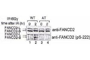 Indicated lymphoblasts (PD7, WT : GM1526, AT) were irradiated with 15 Gy (2), and immunoblotted with anti-FANCD2 and FANCD2 (phospho S222) polyclonal antibody . (FANCD2 Antikörper  (pSer222))