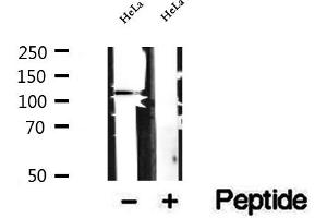 Western blot analysis of extracts of HeLa cells, using DAAM1 antibody. (DAAM1 Antikörper  (Internal Region))