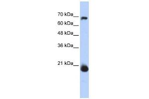 WB Suggested Anti-CHCHD4 Antibody Titration: 0. (CHCHD4 Antikörper  (N-Term))