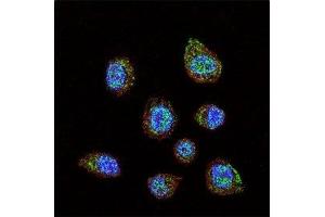 Confocal immunofluorescent analysis of HIF-1 alpha antibody with MDA-MB231 cells followed by Alexa Fluor 488-conjugated goat anti-rabbit lgG (green). (HIF1A Antikörper  (AA 728-757))