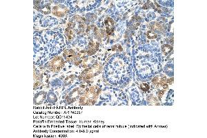 Immunohistochemistry (IHC) image for anti-Heterogeneous Nuclear Ribonucleoprotein L (HNRNPL) (N-Term) antibody (ABIN2778776)