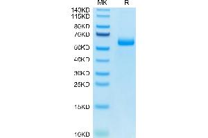 SDS-PAGE (SDS) image for Adiponectin (ADIPOQ) (AA 18-247) protein (Fc Tag) (ABIN7273800)