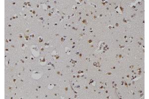 ABIN6279367 at 1/100 staining Human brain tissue by IHC-P. (ZNRD1 Antikörper  (Internal Region))