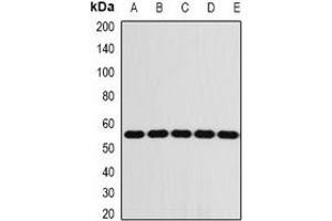 Western blot analysis of FKBP8 expression in Jurkat (A), THP1 (B), mouse liver (C), mouse eye (D), rat brain (E) whole cell lysates. (FKBP8 Antikörper)